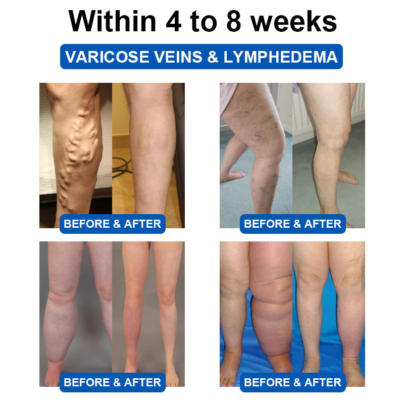 ✅HPRA Certified | 🍀GFOUK™ Ultrasonic Fat Blasting and Detoxing Wristband (🔥LAST DAY 70% OFF)