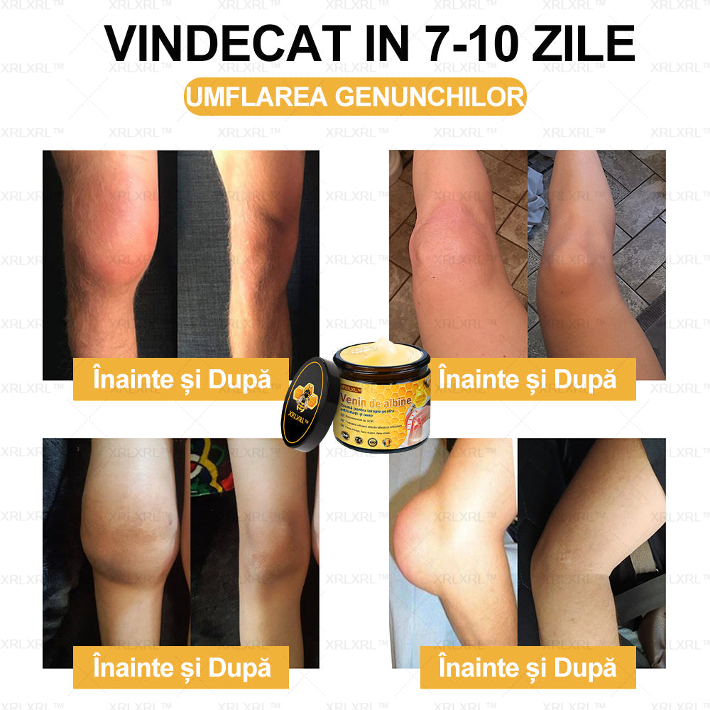 XRLXRL™ csontgyógyító méhméreg fájdalomcsillapító krém (kifejezetten idősebb felnőttek számára, az AAOS által ajánlott)