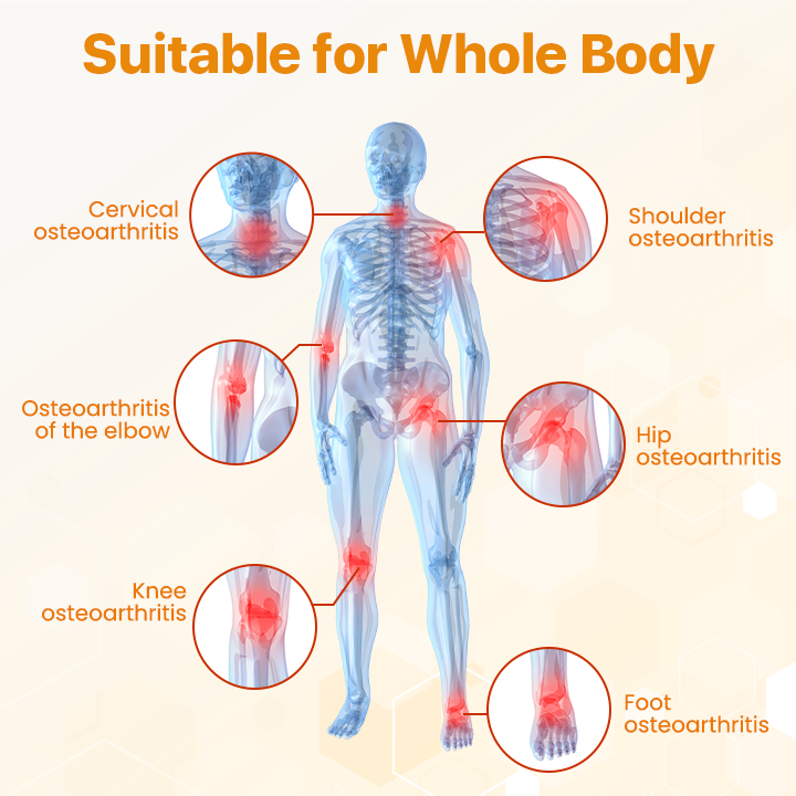 Biancat™ BeeVenom ízületjavító krém