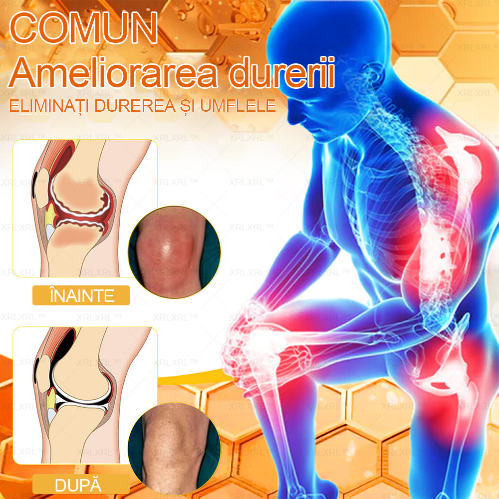 XRLXRL™ csontgyógyító méhméreg fájdalomcsillapító krém (kifejezetten idősebb felnőttek számára, az AAOS által ajánlott)