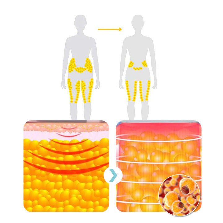 (🔥UTOLSÓ NAP 70% KEDVEZMÉNY) Histone Matteo Ultrasonic Body Shape Wristband Pro 🔥