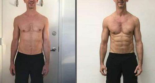 INGYENES SZÁLLÍTÁS AFIZ TURMALIN LYMPH KARCSÚSÍTÓ ORVOSI ZOKNI