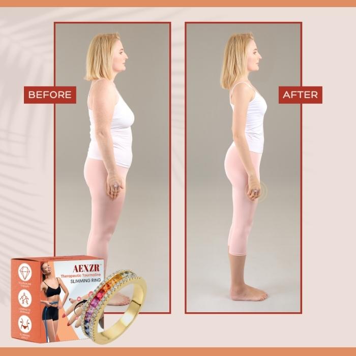 AEXZR™ gyógyító turmalin karcsúsító gyűrű