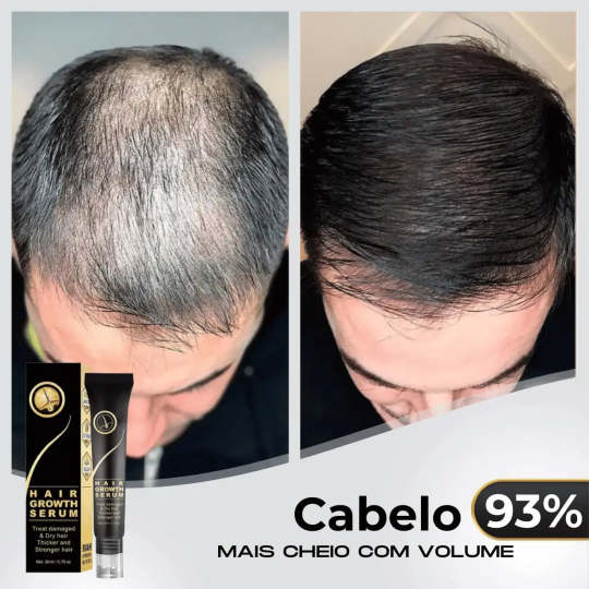 95%-os csökkenés csökkenés, 20x növekedés növekedés | Fix Your Hair®
