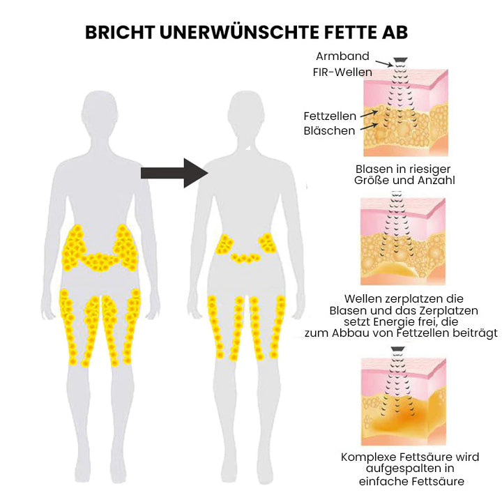 Oveallgo™ MatteoMiracle ultrahangos testformáló karkötő
