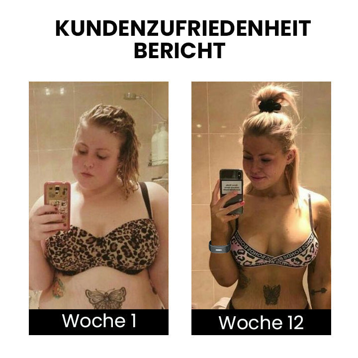 Oveallgo™ MatteoMiracle ultrahangos testformáló karkötő