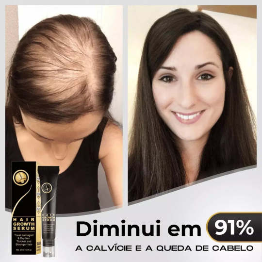 95%-os csökkenés csökkenés, 20x növekedés növekedés | Fix Your Hair®