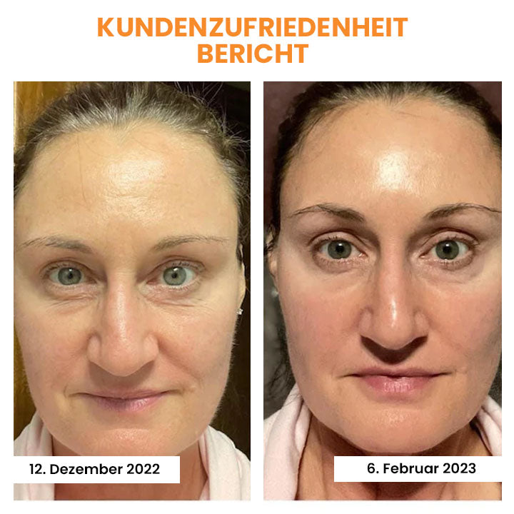 OVEALLGO™ KOREANISCHE ULTIMATIV DERMALAYER-TECHNOLOGY LÖSLICHER KOLLAGENFILM