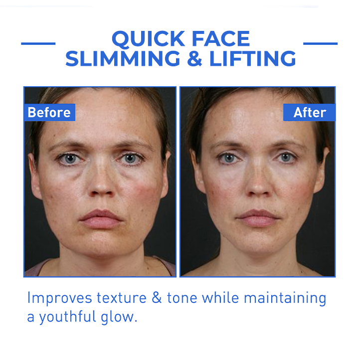 BOTOX ARCSZÉRUM | VEGYÉL 1-ET ÉS KAPSZ 1-ET INGYEN