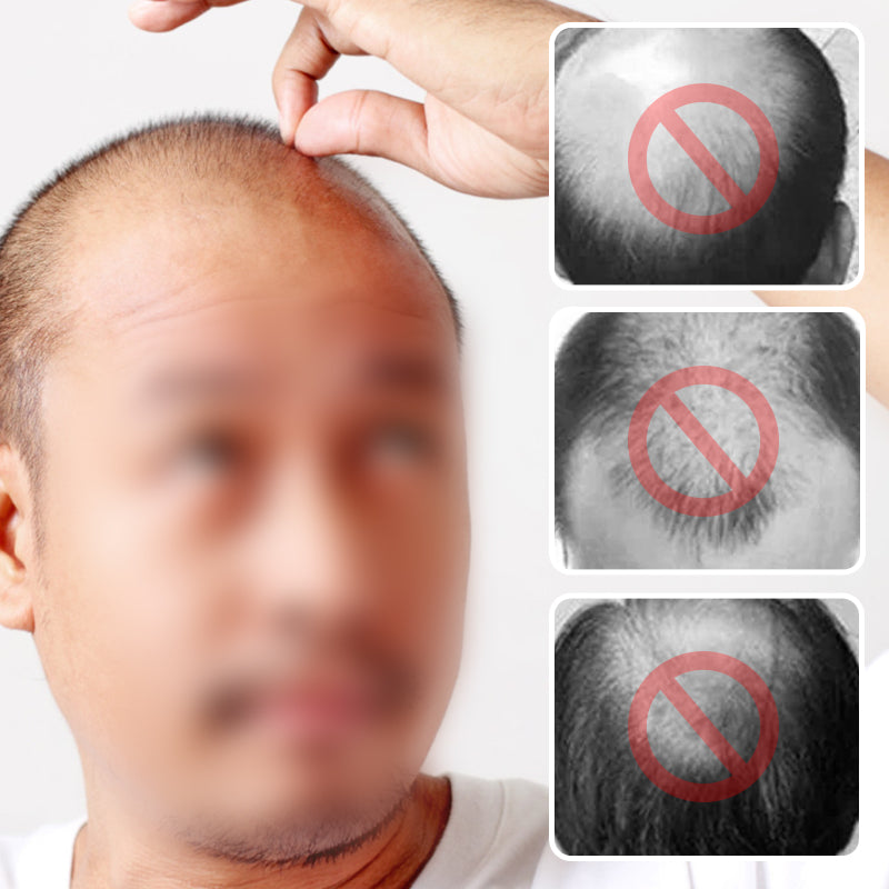 [A legjobb ajándék neki] Természetes és valósághű teljes paróka férfiaknak